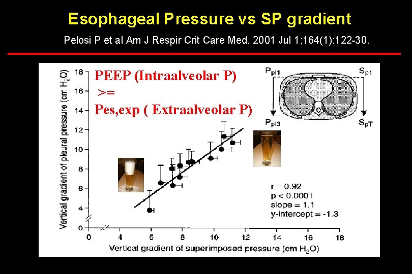 Esophageal Pressure vs SP gradient Pelosi P et al Am J Respir Crit Care