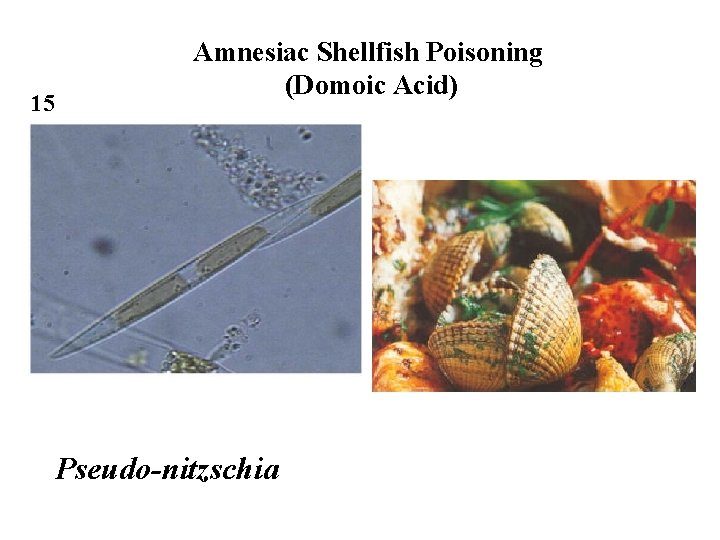 15 Amnesiac Shellfish Poisoning (Domoic Acid) Pseudo-nitzschia 