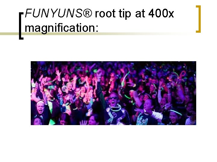 FUNYUNS® root tip at 400 x magnification: FUNYUNS® root tip at 400 x magnification: