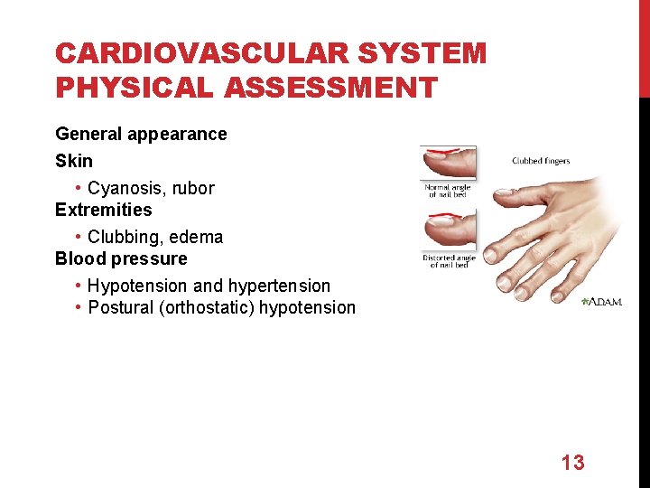 CARDIOVASCULAR SYSTEM PHYSICAL ASSESSMENT General appearance Skin • Cyanosis, rubor Extremities • Clubbing, edema