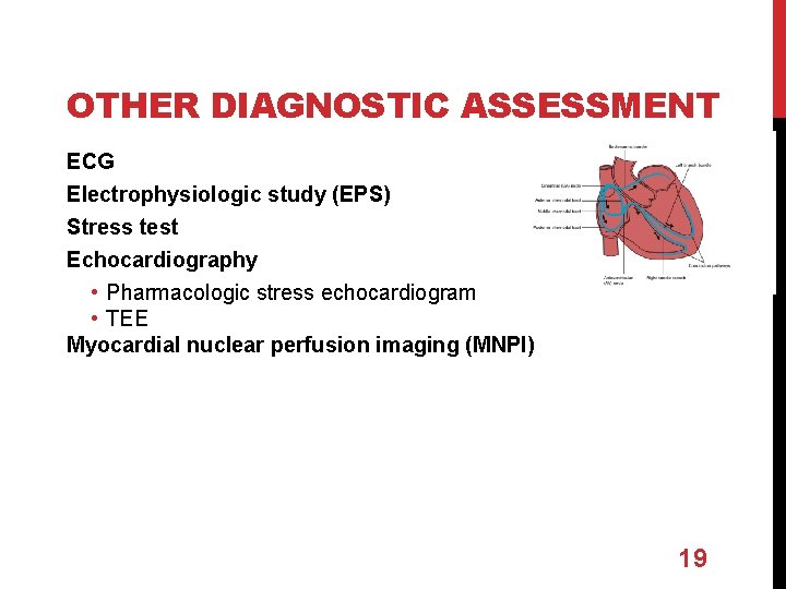 OTHER DIAGNOSTIC ASSESSMENT ECG Electrophysiologic study (EPS) Stress test Echocardiography • Pharmacologic stress echocardiogram