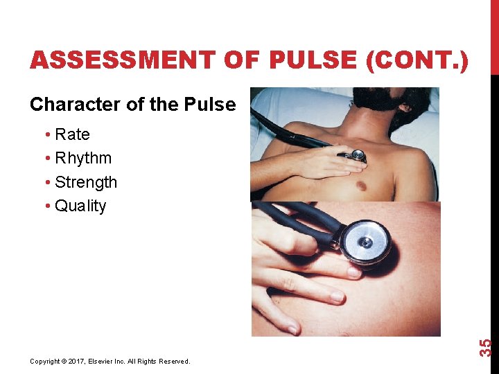 ASSESSMENT OF PULSE (CONT. ) Character of the Pulse Copyright © 2017, Elsevier Inc.