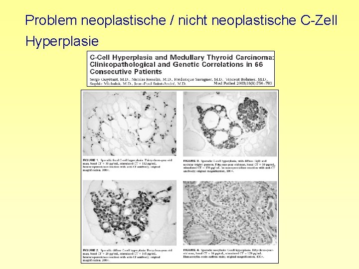 Problem neoplastische / nicht neoplastische C-Zell Hyperplasie 