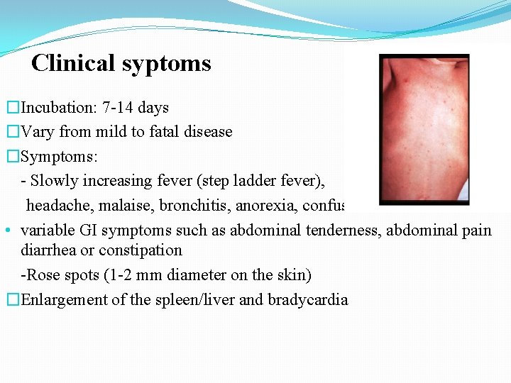 Clinical syptoms �Incubation: 7 -14 days �Vary from mild to fatal disease �Symptoms: - Clinical syptoms �Incubation: 7 -14 days �Vary from mild to fatal disease �Symptoms: -