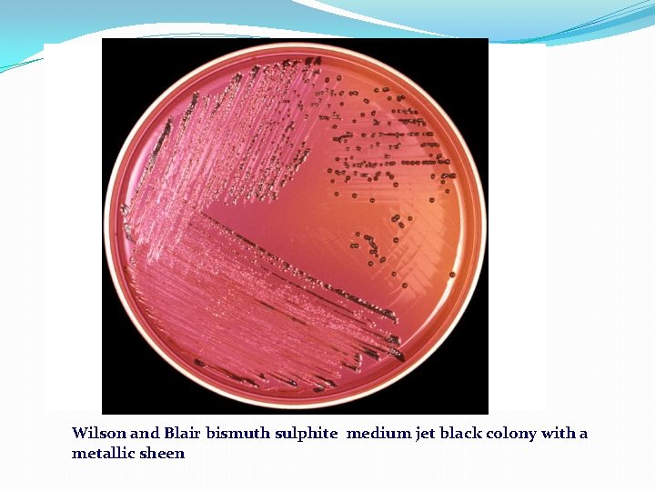 Wilson and Blair bismuth sulphite medium jet black colony with a metallic sheen Wilson and Blair bismuth sulphite medium jet black colony with a metallic sheen