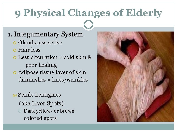 9 Physical Changes of Elderly 1. Integumentary System Glands less active Hair loss Less