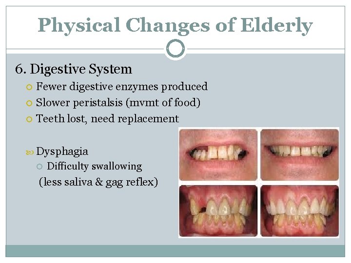 Physical Changes of Elderly 6. Digestive System Fewer digestive enzymes produced Slower peristalsis (mvmt