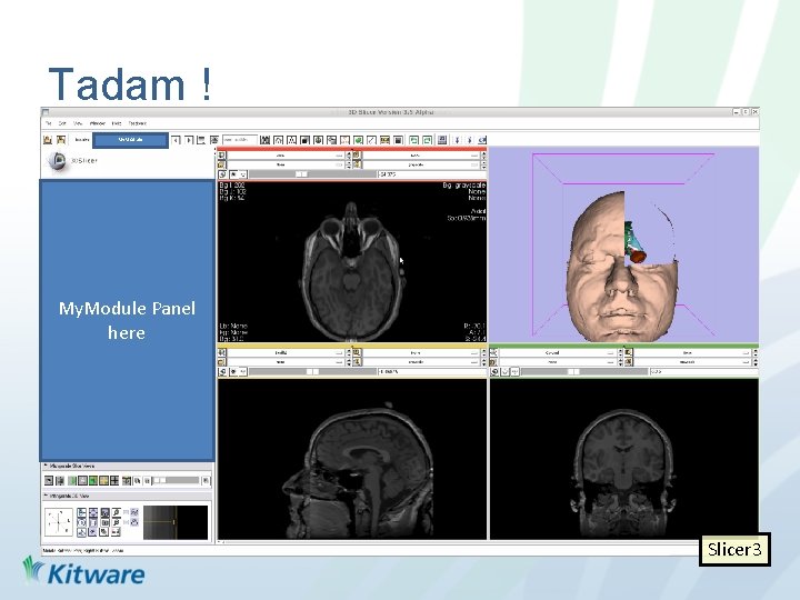 Tadam ! My. Module Panel here Slicer 3 