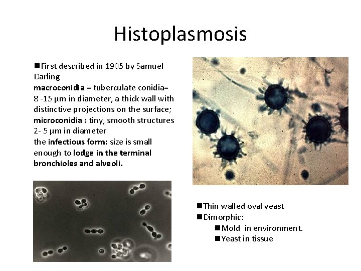 Histoplasmosis n. First described in 1905 by Samuel Darling macroconidia = tuberculate conidia= 8