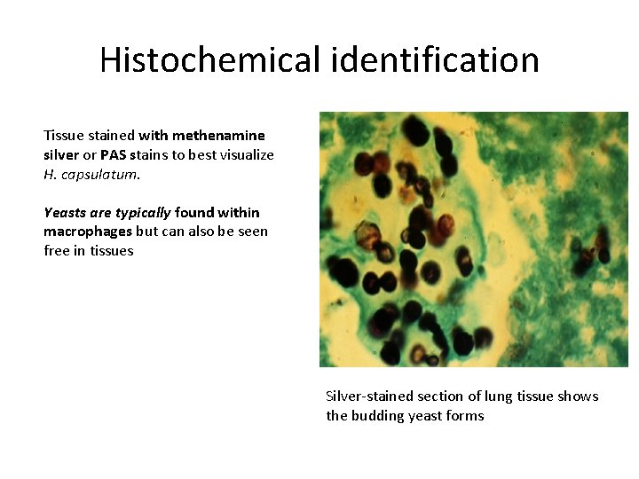 Histochemical identification Tissue stained with methenamine silver or PAS stains to best visualize H.