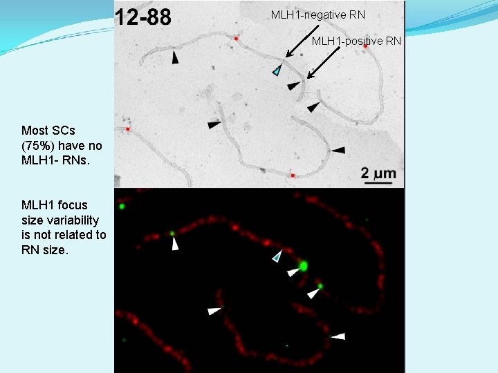MLH 1 -negative RN MLH 1 -positive RN Most SCs (75%) have no MLH