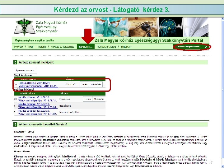 Kérdezd az orvost - Látogató kérdez 3. 17 