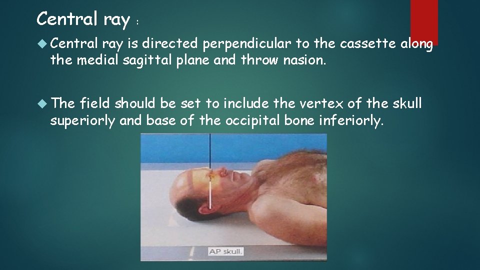 Central ray : Central ray is directed perpendicular to the cassette along the medial