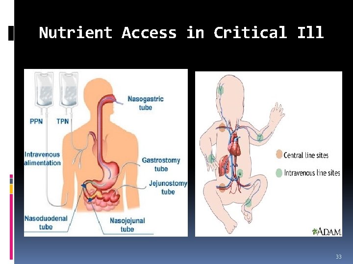 Nutrient Access in Critical Ill 33 