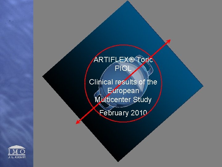 ARTIFLEX® Toric PIOL Clinical results of the European Multicenter Study February 2010 