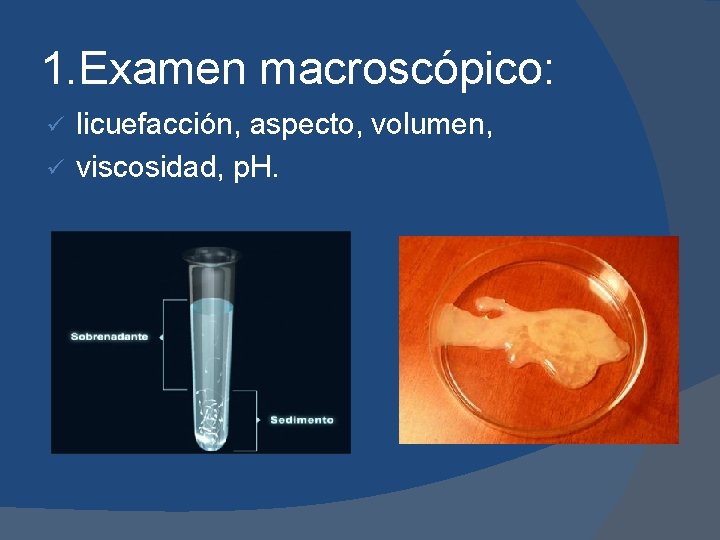 1. Examen macroscópico: licuefacción, aspecto, volumen, ü viscosidad, p. H. ü 