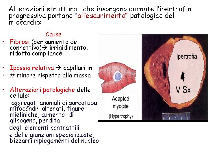 Alterazioni strutturali che insorgono durante l’ipertrofia progressiva portano “all’esaurimento” patologico del miocardio: Cause •