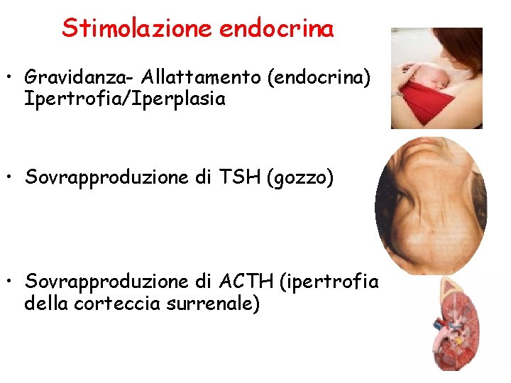 Stimolazione endocrina • Gravidanza- Allattamento (endocrina) Ipertrofia/Iperplasia • Sovrapproduzione di TSH (gozzo) • Sovrapproduzione