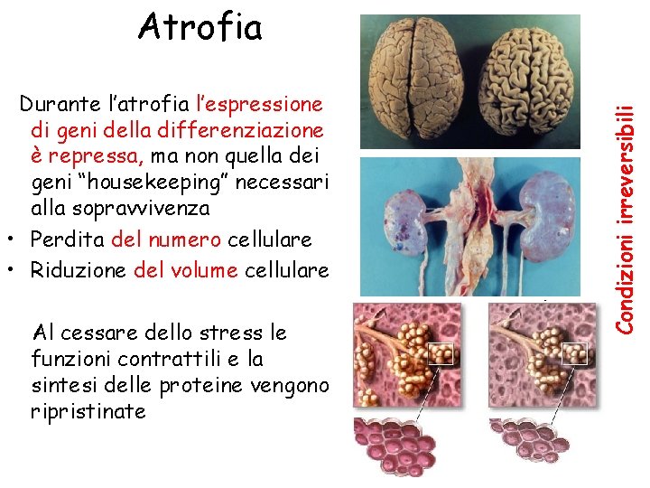 Durante l’atrofia l’espressione di geni della differenziazione è repressa, ma non quella dei geni