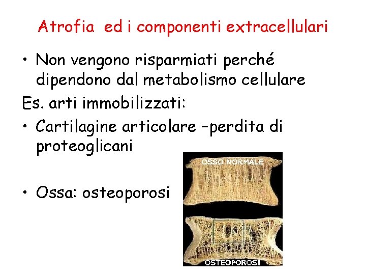 Atrofia ed i componenti extracellulari • Non vengono risparmiati perché dipendono dal metabolismo cellulare