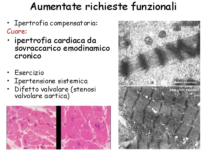 Aumentate richieste funzionali • Ipertrofia compensatoria: Cuore: • ipertrofia cardiaca da sovraccarico emodinamico cronico