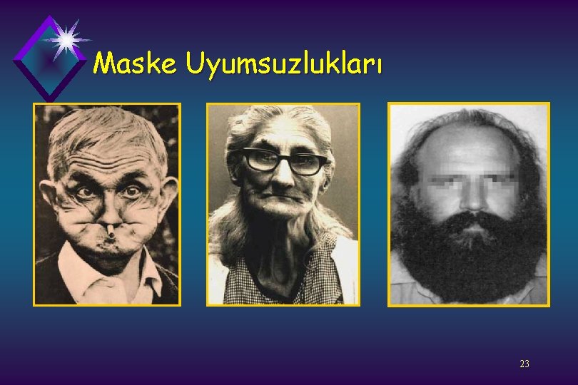 Maske Uyumsuzlukları 23 