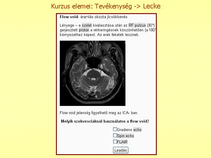 Kurzus elemei: Tevékenység -> Lecke 