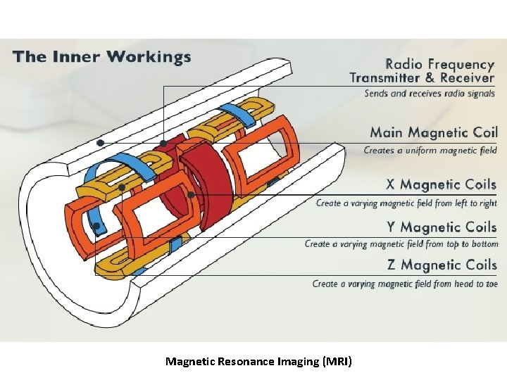 Magnetic Resonance Imaging (MRI) 