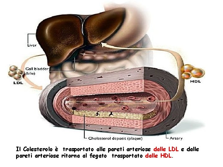 Il Colesterolo è trasportato alle pareti arteriose dalle LDL e dalle pareti arteriose ritorna