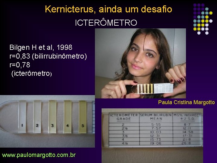 Kernicterus, ainda um desafio ICTERÔMETRO Bilgen H et al, 1998 r=0, 83 (bilirrubinômetro) r=0,