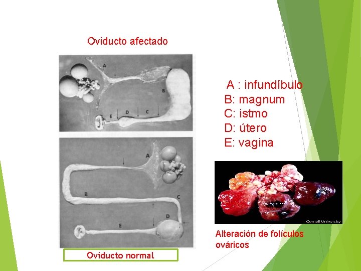 Oviducto afectado A : infundíbulo B: magnum C: istmo D: útero E: vagina Alteración