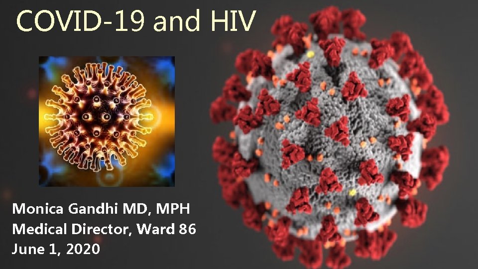 COVID-19 and HIV Monica Gandhi MD, MPH Medical Director, Ward 86 June 1, 2020