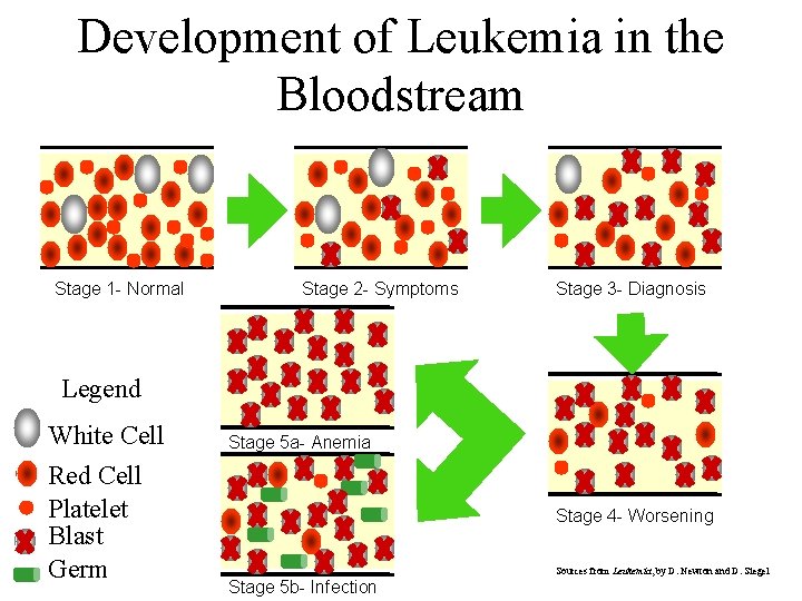 Development of Leukemia in the Bloodstream Stage 1 - Normal Stage 2 - Symptoms Development of Leukemia in the Bloodstream Stage 1 - Normal Stage 2 - Symptoms