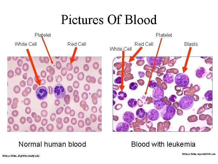 Pictures Of Blood Platelet White Cell Platelet Red Cell Normal human blood Sources from