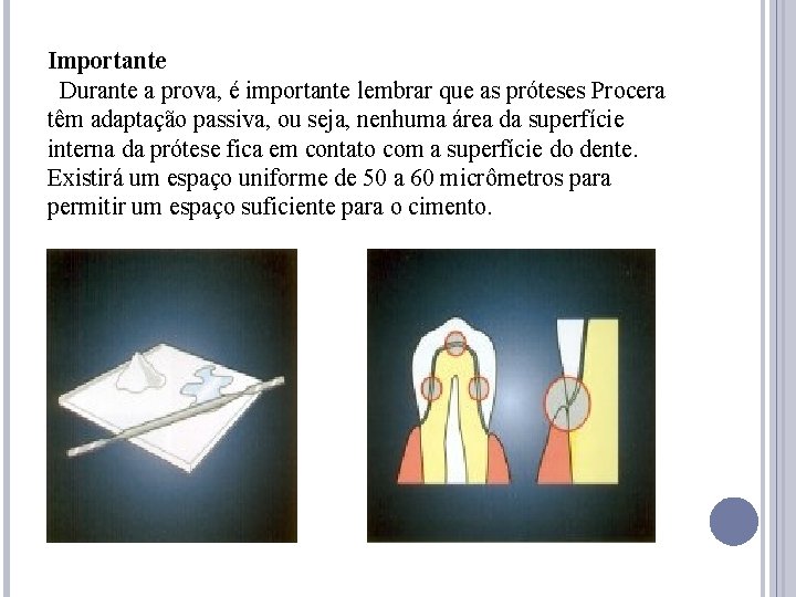 Importante Durante a prova, é importante lembrar que as próteses Procera têm adaptação passiva,