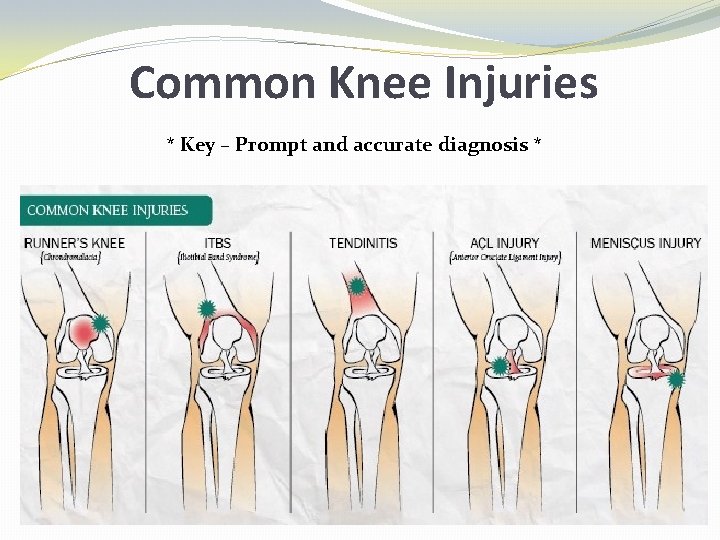 Common Knee Injuries * Key – Prompt and accurate diagnosis * 