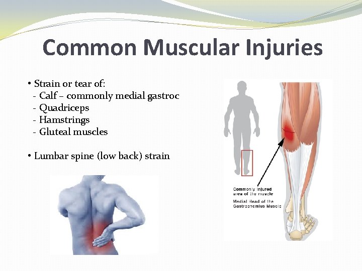 Common Muscular Injuries • Strain or tear of: - Calf – commonly medial gastroc