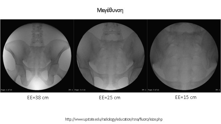 Μεγέθυνση EE=38 cm EE=25 cm http: //www. upstate. edu/radiology/education/rsna/fluoro/iisize. php EE=15 cm 