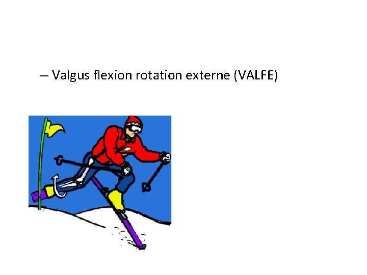 – Valgus flexion rotation externe (VALFE) 