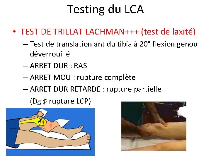 Testing du LCA • TEST DE TRILLAT LACHMAN+++ (test de laxité) – Test de