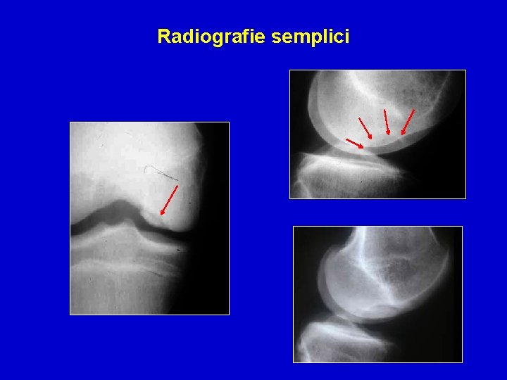 Radiografie semplici 