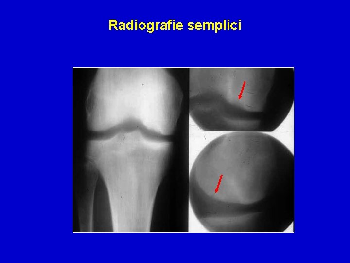 Radiografie semplici 