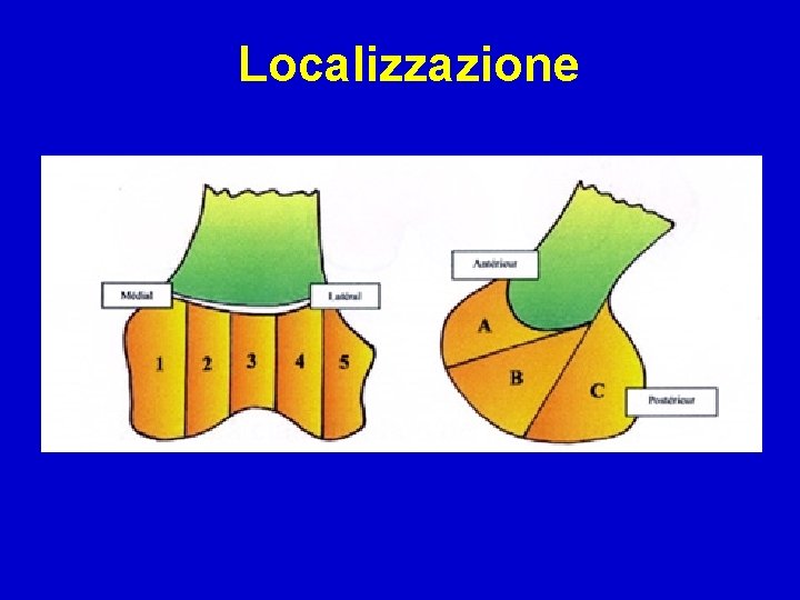 Localizzazione 