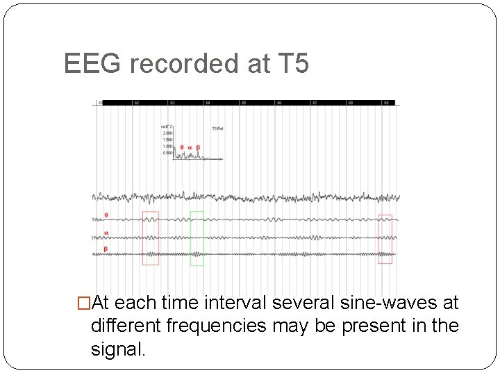 EEG recorded at T 5 �At each time interval several sine-waves at different frequencies
