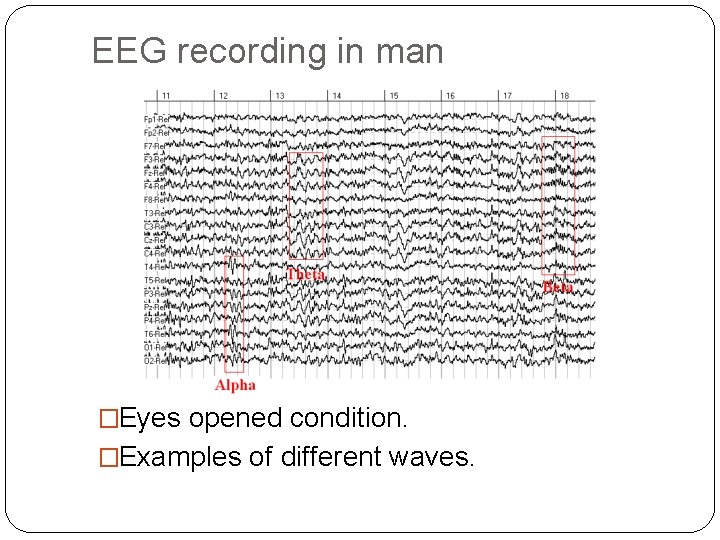 EEG recording in man �Eyes opened condition. �Examples of different waves. 