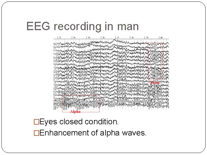 EEG recording in man �Eyes closed condition. �Enhancement of alpha waves. 