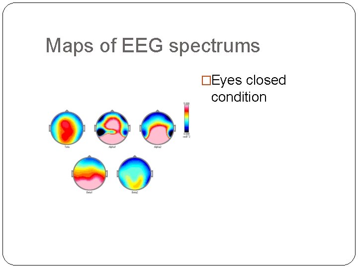 Maps of EEG spectrums �Eyes closed condition 