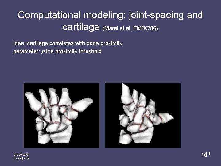 Computational modeling: joint-spacing and cartilage (Marai et al, EMBC'06) Idea: cartilage correlates with bone