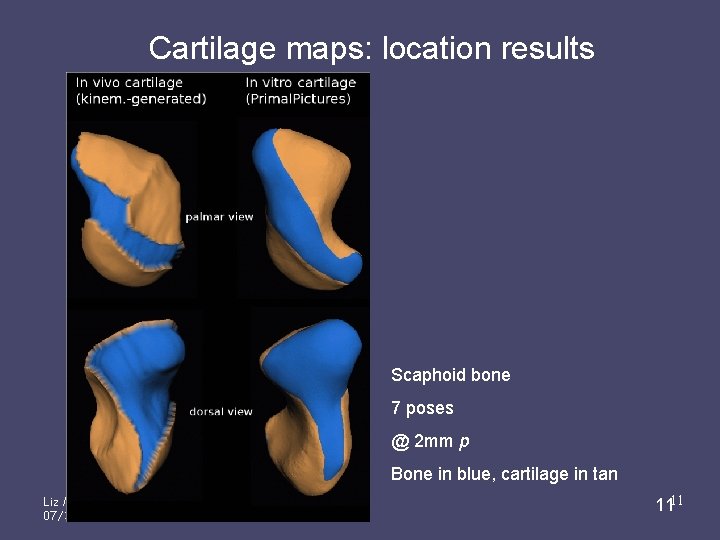 Cartilage maps: location results Scaphoid bone 7 poses @ 2 mm p Bone in