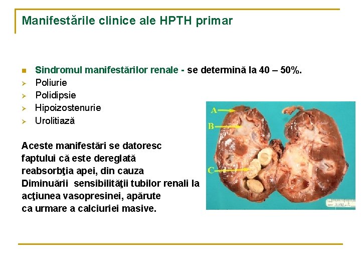 Manifestările clinice ale HPTH primar n Ø Ø Sindromul manifestărilor renale - se determină Manifestările clinice ale HPTH primar n Ø Ø Sindromul manifestărilor renale - se determină